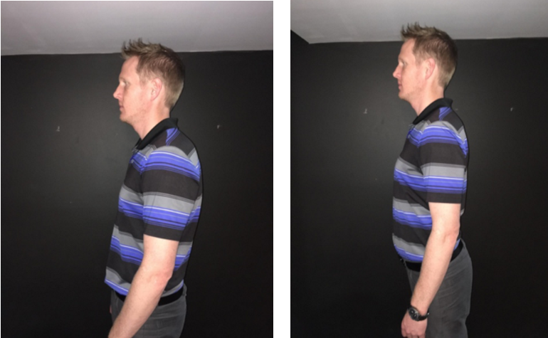 The Best Posture is your NEXT Posture – Cross Works Physiotherapy